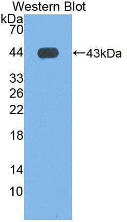 Phospholipase D Antibody (aa725-1074, PE)