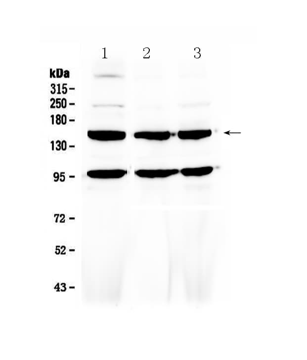 Polyclonal Rabbit anti-Human FLT4 / VEGFR3 Antibody (IHC, WB)