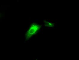 LIPG / Endothelial Lipase Antibody (clone OTI4D2, Carrier-free)
