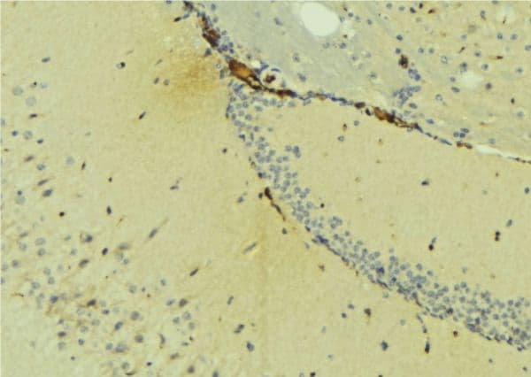NDRG4 Antibody