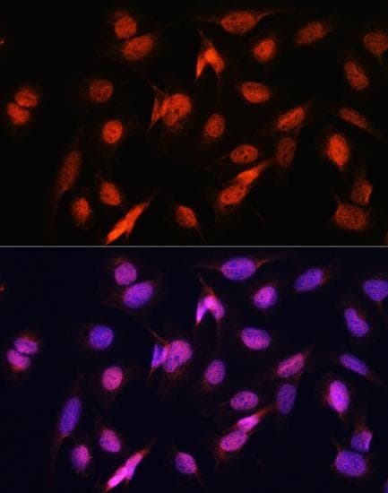OTUB1 / OTU1 Antibody