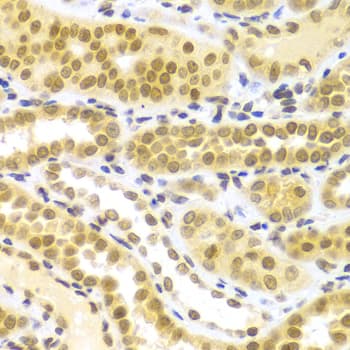 ELAVL1 / HUR Antibody