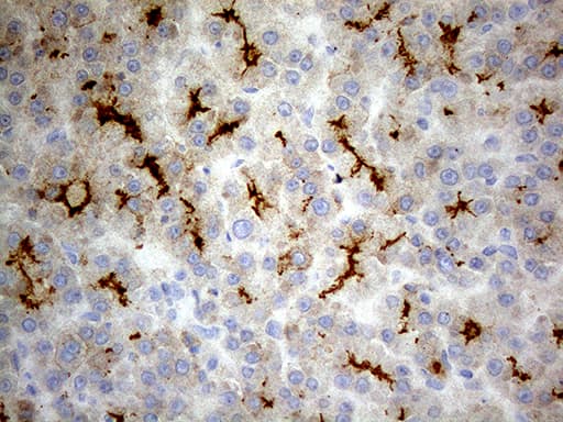 ABCB1 / MDR1 / P Glycoprotein Antibody (aa995-1280, clone OTI2H2)