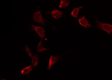 FOXO4 / AFX1 Antibody