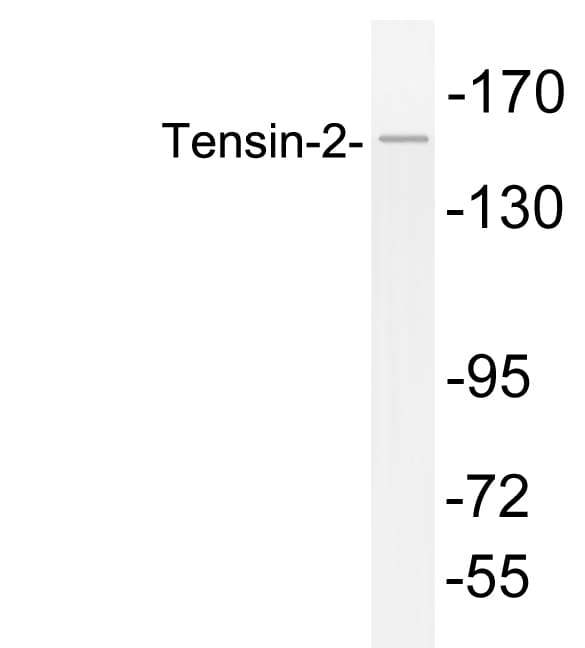 TNS2 / TENC1 Antibody (aa439-488)