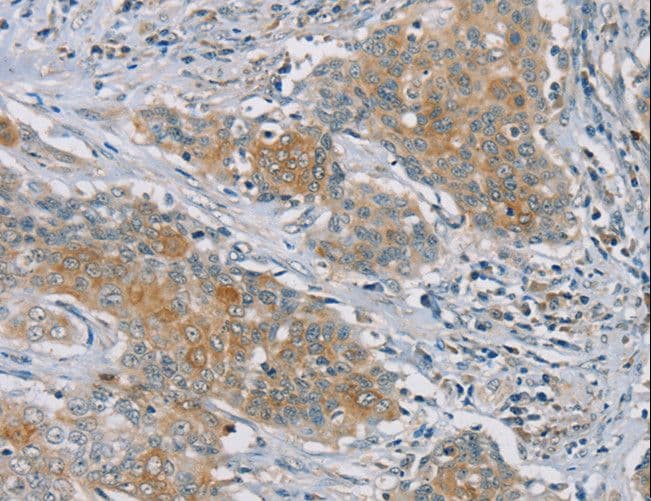 Polyclonal Rabbit anti-Human RASA2 Antibody (IHC)
