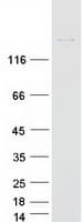 Human INT1 / INTS1 Protein (Recombinant Myc-DDK (Flag))