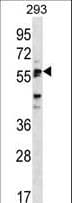 SIGLEC6 Antibody (aa381-412)