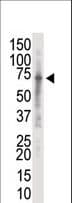 IRAK2 / IRAK-2 Antibody (aa549-581)