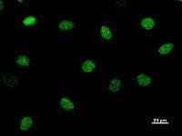 CHD1L Antibody (clone 2170C3a)
