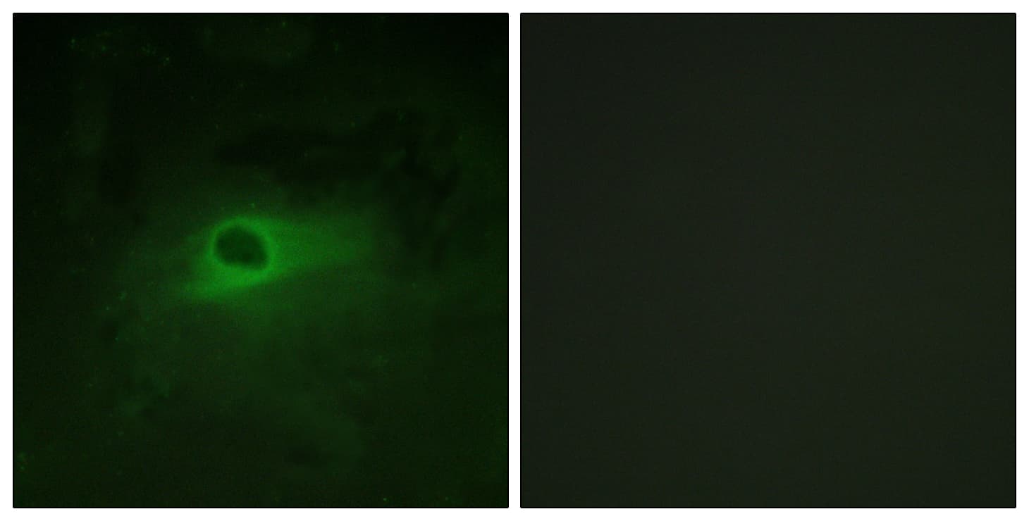 CSF1R / CD115 / FMS Antibody (aa781-830)