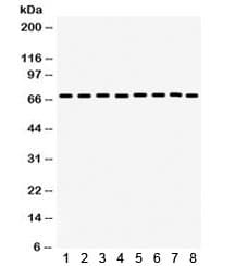 Polyclonal Rabbit anti-Human PTPN11 / SHP-2 / NS1 Antibody (IHC, WB)