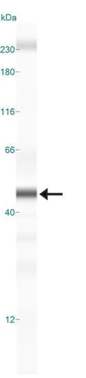 AIMP1 / EMAP II Antibody (aa260-310)