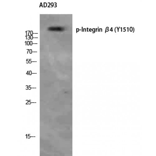 ITGB4 / Integrin Beta 4 Antibody (1450-1530 aa)