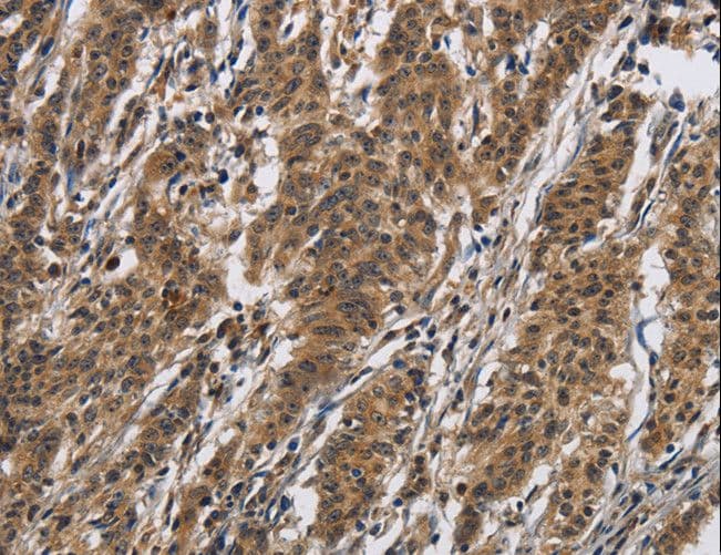 IL12RB2 Antibody