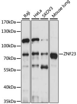 Polyclonal Rabbit anti-Human ZNF23 Antibody (WB)