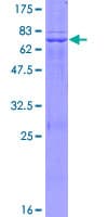 Human LDHAL6B Protein (Recombinant GST)