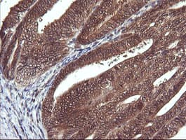 Monoclonal Mouse anti-Human DDT / Dopamine Tautomerase Antibody (clone OTI1A1, IHC, WB)