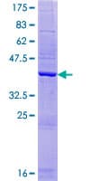 Human AHSA2 Protein (Recombinant GST)