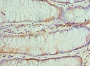 TRADD Antibody (aa1-312)