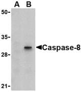 IHC-plus™ Polyclonal Rabbit anti-Human CASP8 / Caspase 8 Antibody (IHC, WB)