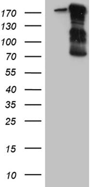 IQGAP1 Antibody (aa464-609, clone OTI7F5, Carrier-free)