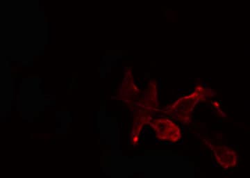 Polyclonal Rabbit anti-Human RAB2B Antibody (IF, WB)