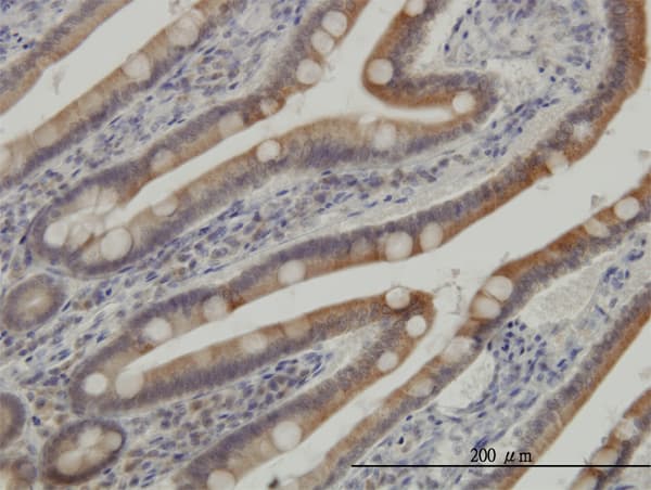 CSNK1G1 / CKI-Gamma 1 Antibody (clone 2E10)