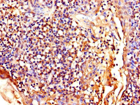 LEF1 Antibody