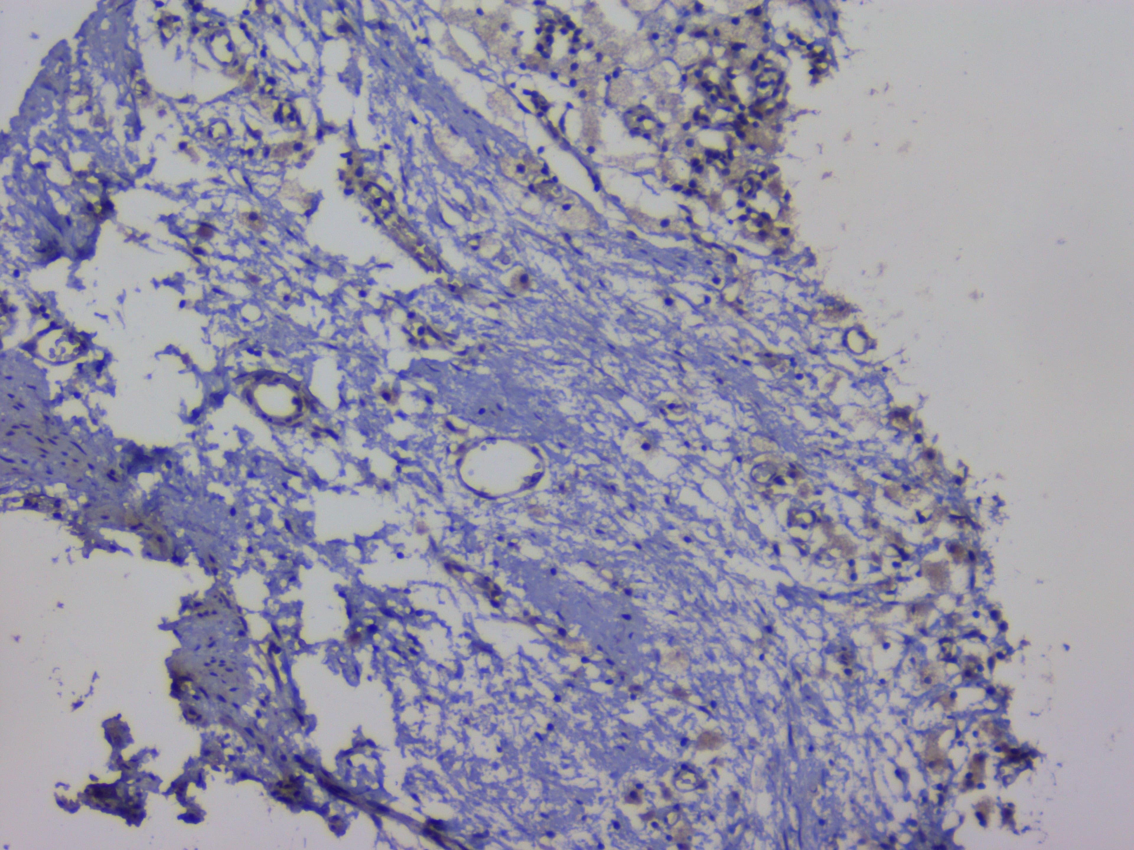 NRF1 / NRF-1 Antibody