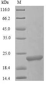 Chum salmon L-rhamnose-binding lectin CSL3 Protein (Recombinant 10His, N-terminus)