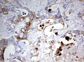 KRT20 / CK20 / Cytokeratin 20 Antibody (clone OTI5F7)