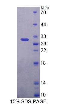 Human PLCH2 Protein (Recombinant His-T7, N-terminus)