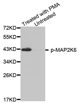 MAP2K6 / MEK6 / MKK6 Antibody (phospho-Ser207)