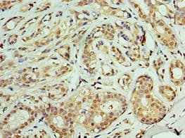 TIMM21 Antibody (aa1-248)