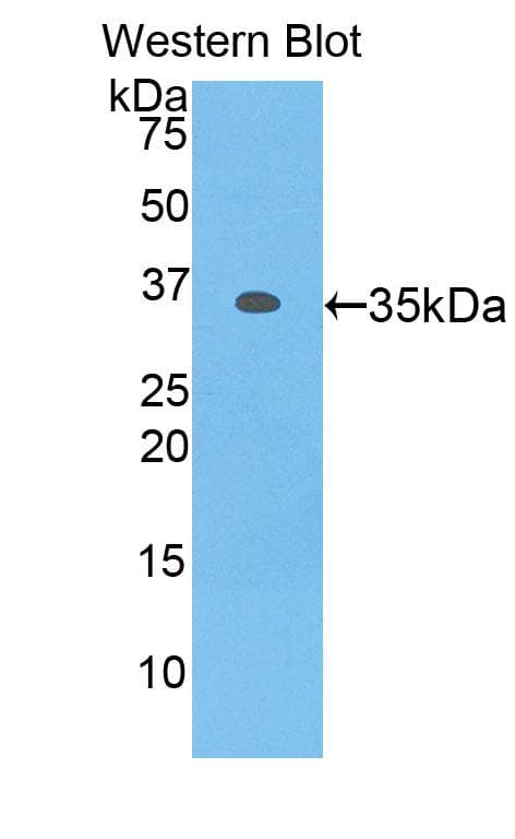 MYO1F Antibody (aa491-767)