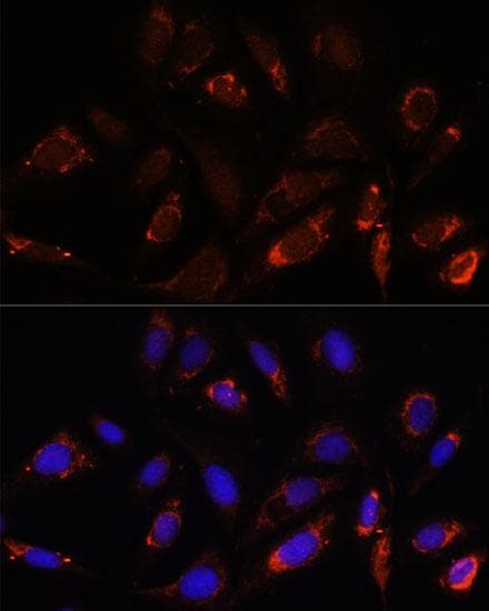 MRPL23 Antibody