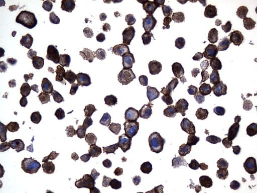 MME / CD10 Antibody (aa411-750, clone UMAB235)