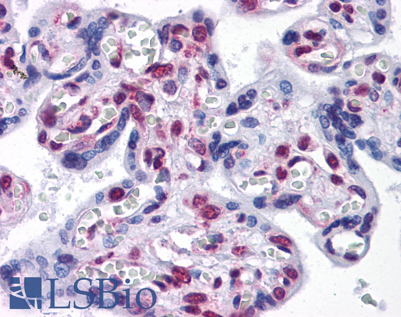 IHC-plus™ STK33 Antibody (clone 3F10)