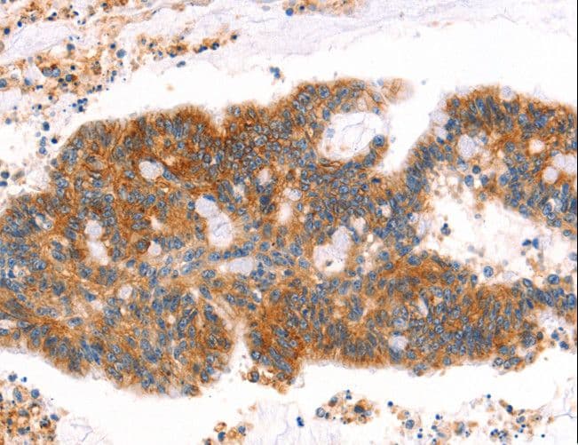 Polyclonal Rabbit anti-Human MLLT4 / Afadin Antibody (IHC)