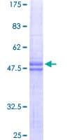 Human IER3 / IEX-1 Protein (Recombinant GST)