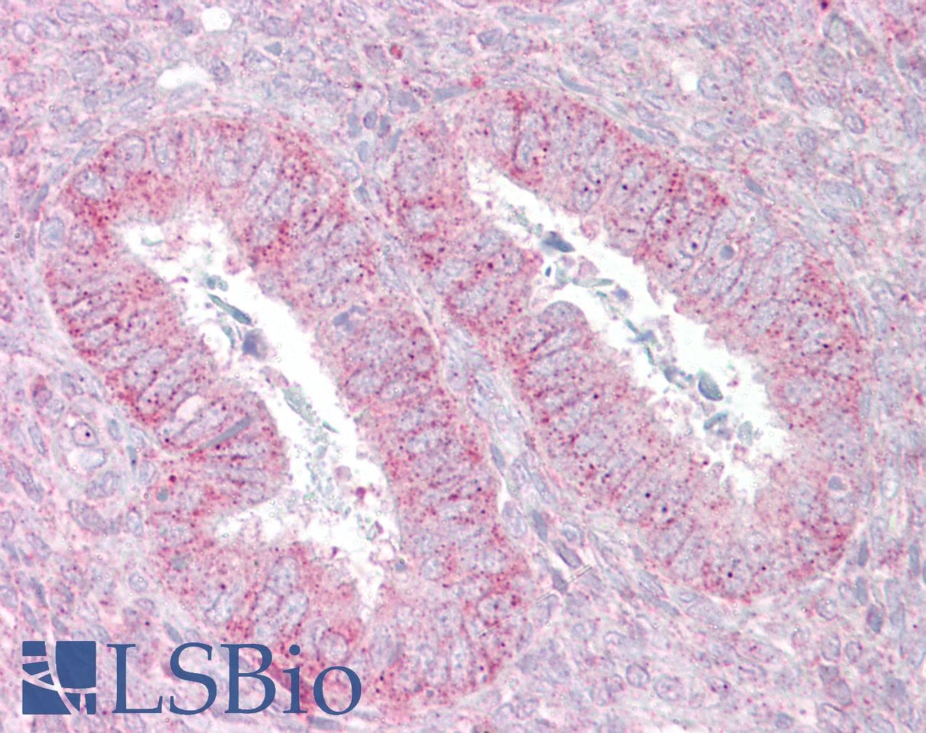 Polyclonal Rabbit anti-Human SUFU Antibody (C-Terminus, IHC, WB)
