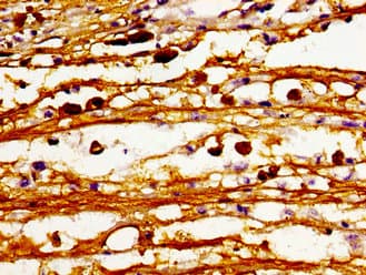 CerS6 / LASS6 Antibody