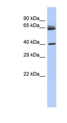 CHN2 / Chimerin 2 Antibody (aa71-120)