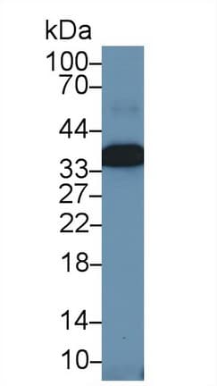 ANXA4 / Annexin IV Antibody (aa3-151)