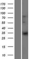 ELOVL1 Protein (Over-Expression Lysate Myc-DDK (Flag))