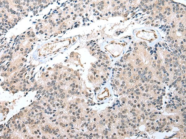 Polyclonal Rabbit anti-Human S100A16 Antibody (IHC, WB)