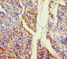 ALDH1L2 Antibody