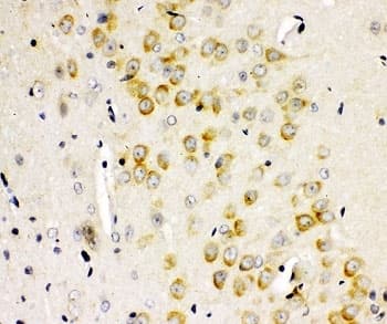 GRM2 / MGLUR2 Antibody (aa25-360)