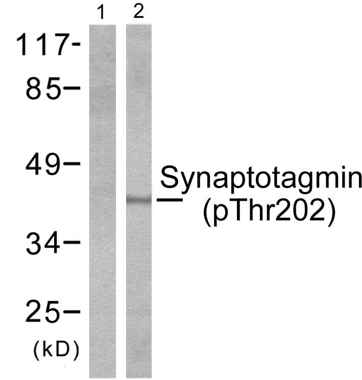 SYT1 / Synaptotagmin Antibody (phospho-Thr202)